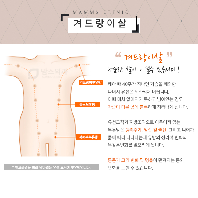 겨드랑이살 제거방법 관련 이미지 2