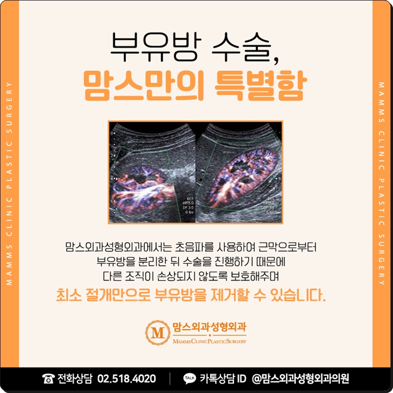 겨드랑이멍울을 떼어낼 방법을 찾고 있나요? 관련 이미지 6