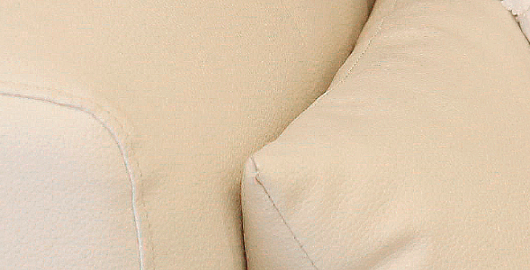 Safe Axillary Accessory Breast Removal Surgery with the Touch of a Breast Surgery Specialist! image 20