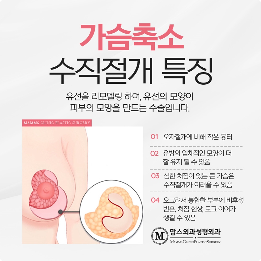 가슴축소수술 흉터 제대로 생각해야해요! 관련 이미지 4