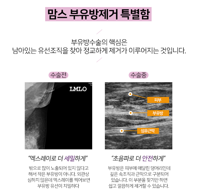 모유수유겨드랑이멍울 갑자기생겼다 관련 이미지 4