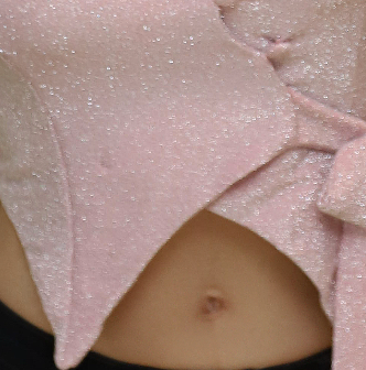 How Can a Systematic Management Method Help Fade Breast Reduction Scars? image 22