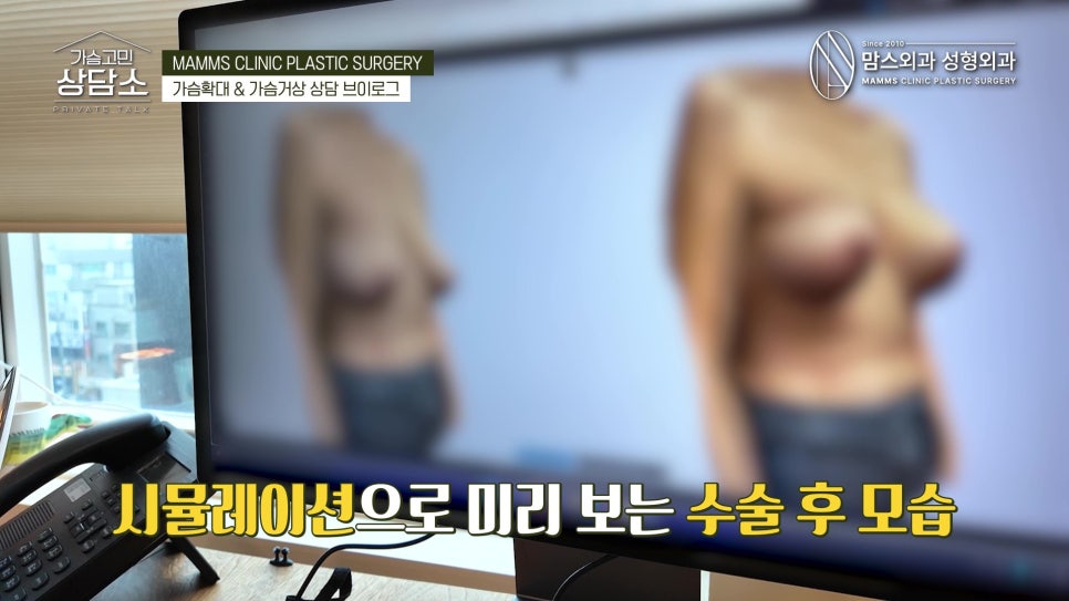 가슴거상 상담 실제로는 이렇게 진행됩니다! 관련 이미지 12