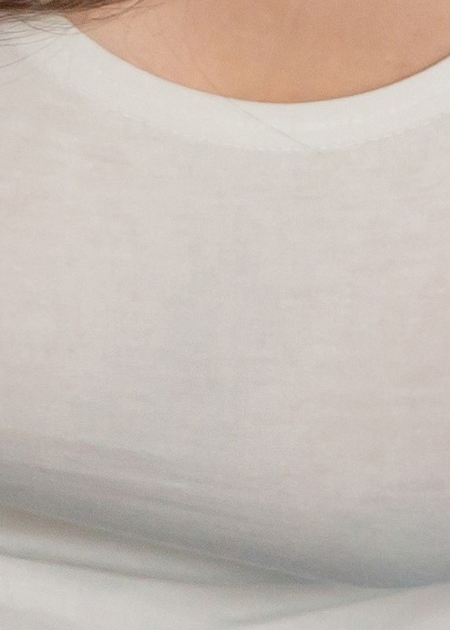겨드랑이유선 깨끗하게 관련 이미지 21