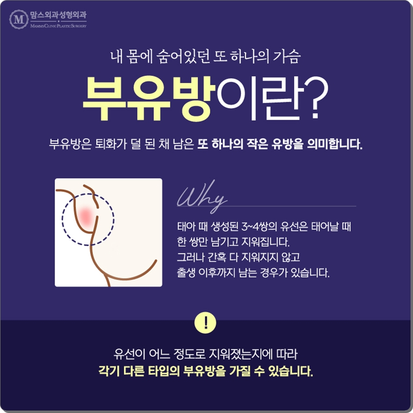 부유방제거수술 내게 맞는 것으로 관련 이미지 2