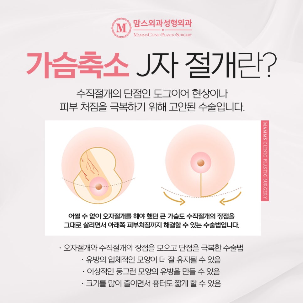 유방축소술 개인의 체형에 맞게! 관련 이미지 3