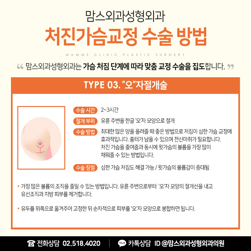 처진가슴수술비용 추가 부담 없는 합리적인 선택을 하고 싶다면 관련 이미지 5