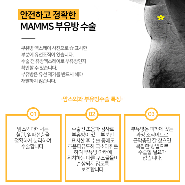부유방수술비용 실력까지함께 관련 이미지 2