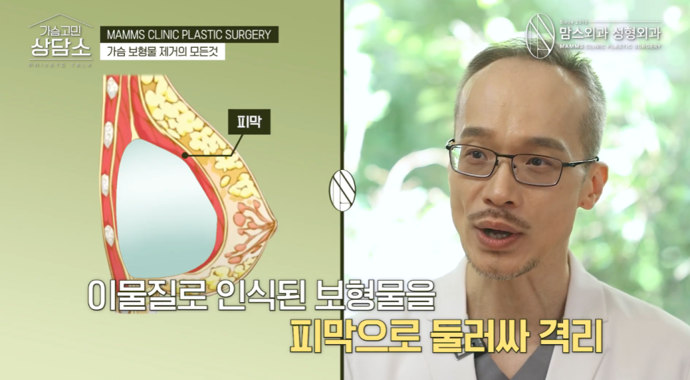 가슴 보형물 수술 10년 후, 왜 결국 관련 이미지 3