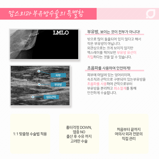 임산부부유방 속앓이는그만 관련 이미지 4