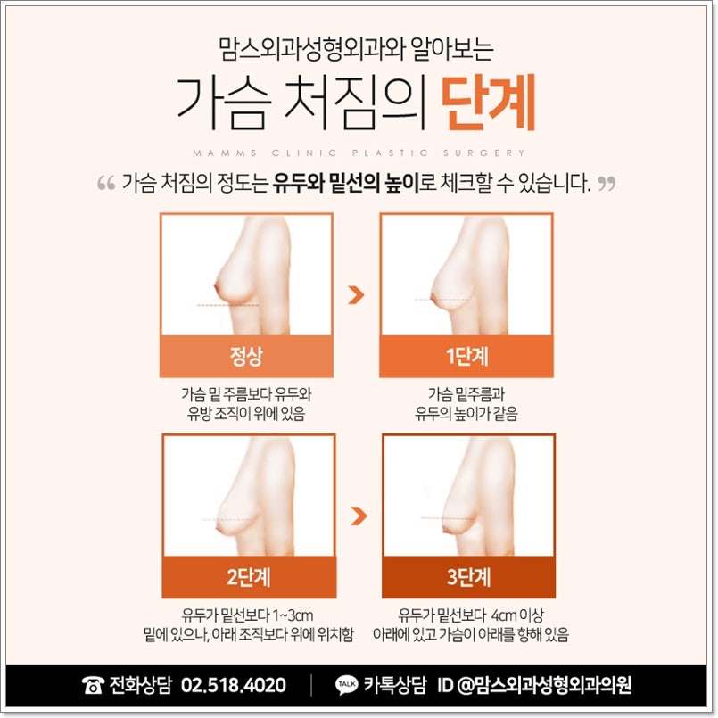 Breast Sagging Surgery to Regain Firmness image 4