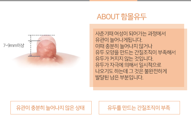 함몰유두교정술 찾고있나요 관련 이미지 2