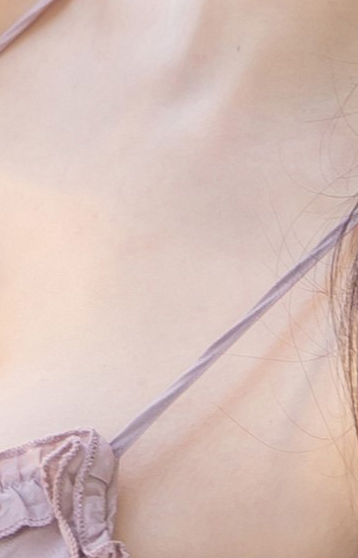Satisfying Results from Areola Reduction Surgery image 19