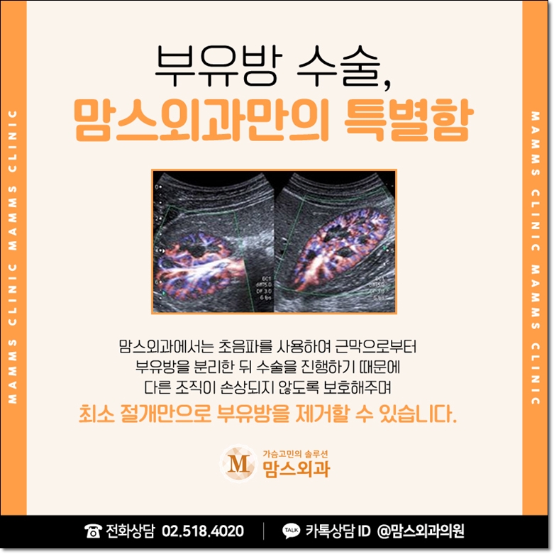 겨드랑이지방흡입 고려한다면 관련 이미지 9