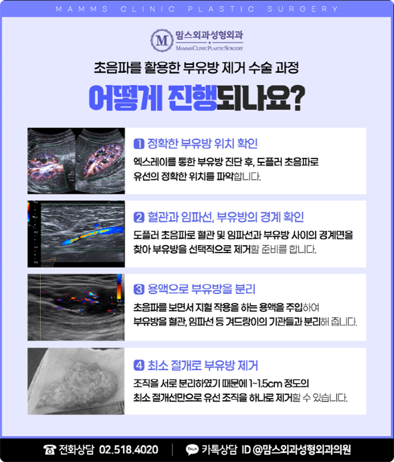 부유방통증 잘 살펴보세요! 관련 이미지 7