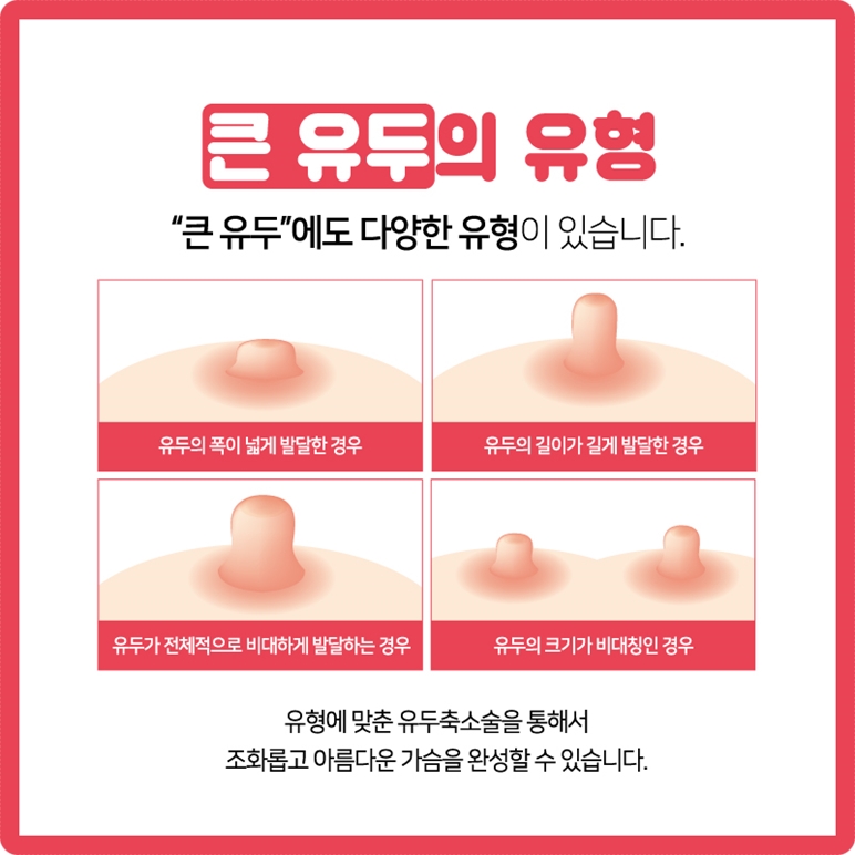 젖꼭지축소 아름다운 자신감 관련 이미지 6