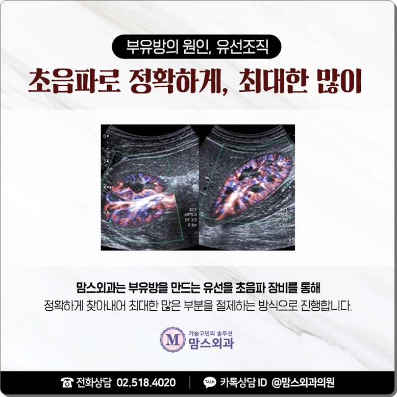 겨드랑이부유방제거비용 체크해볼까? 관련 이미지 6