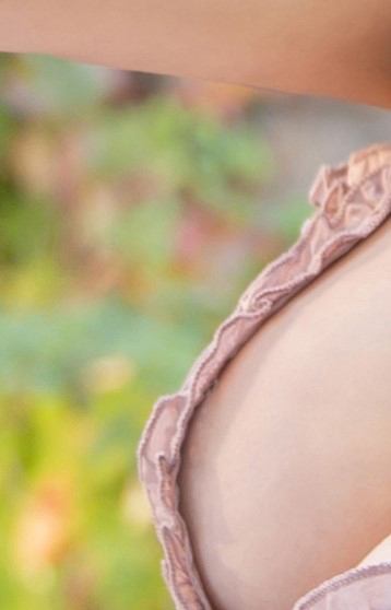 Satisfying Results from Areola Reduction Surgery image 17