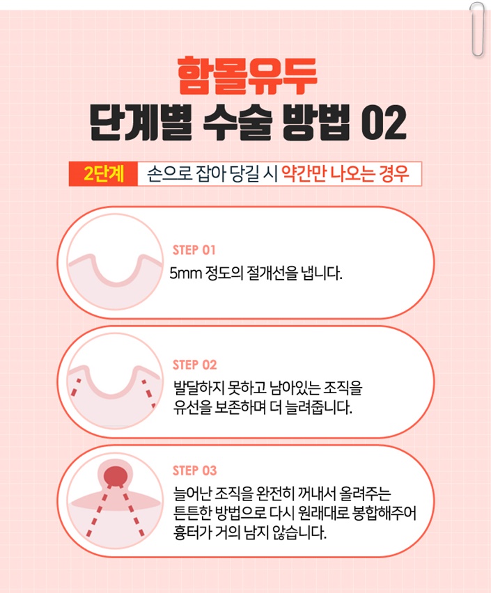 함몰유두교정 답을 찾으세요? 관련 이미지 10