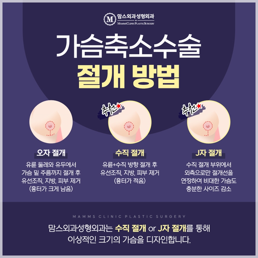 Breast Hypertrophy, Because It’s Difficult image 4