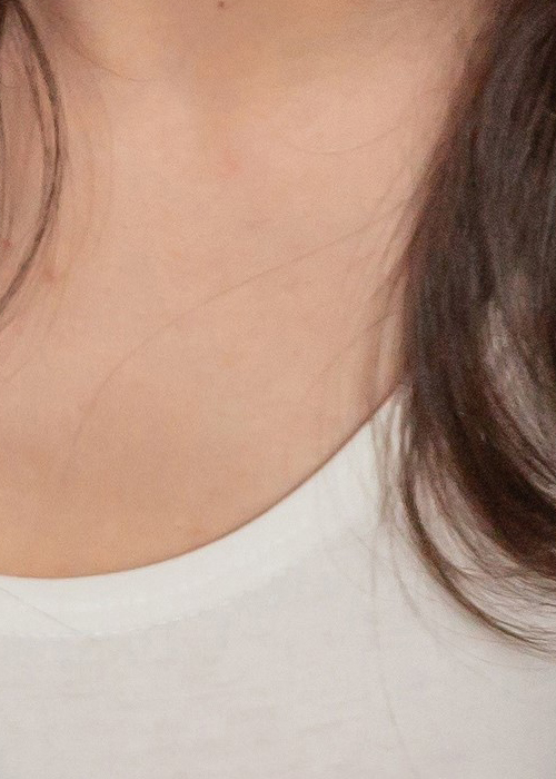 겨드랑이유선 깨끗하게 관련 이미지 18