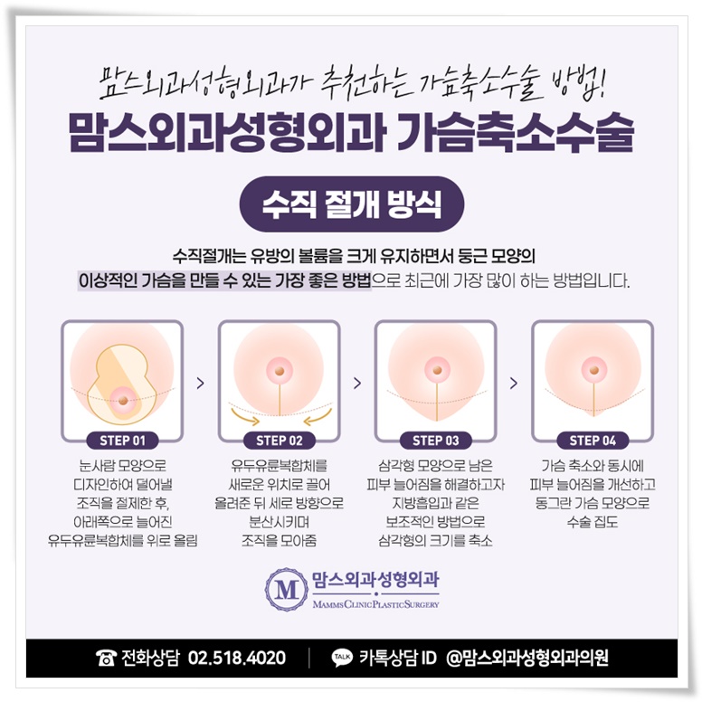 가슴축소를 통한 가슴지방흡입 가벼운 무게로, 관련 이미지 6