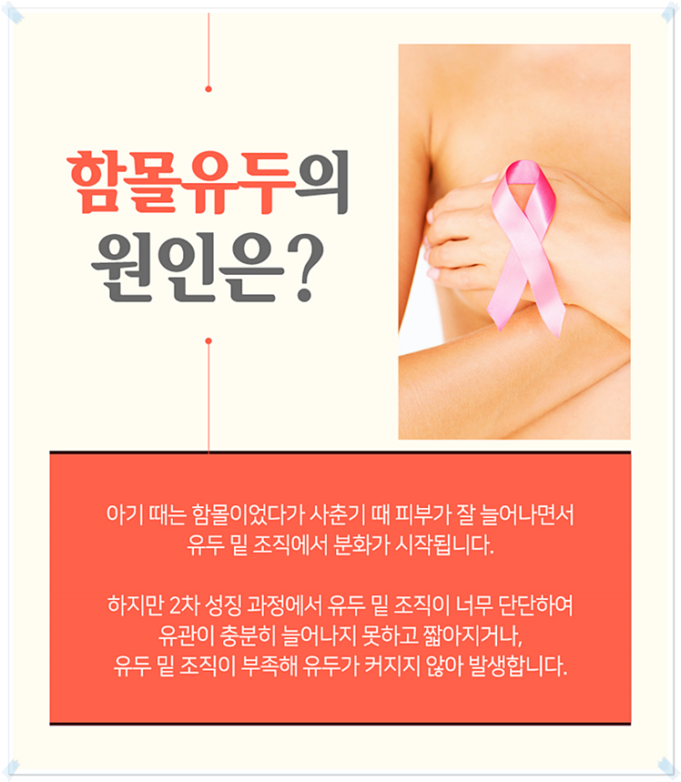 함몰유두수술가격 단계별로 생각해보자! 관련 이미지 3
