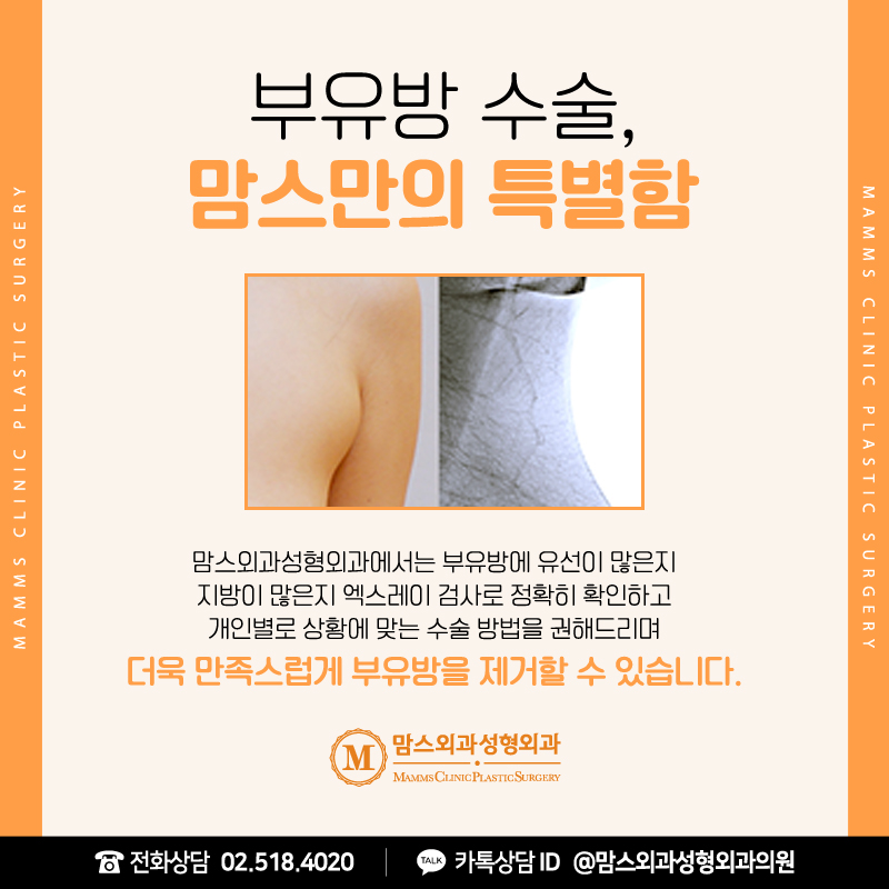 When Is Axillary Breast Tissue Liposuction Possible? image 6