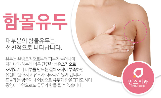 함몰유두교정 모유수유까지 관련 이미지 2