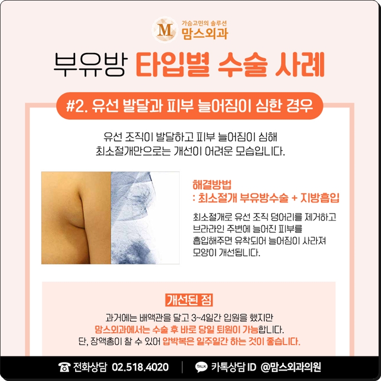 부유방통증 겪고 있다면? 관련 이미지 6
