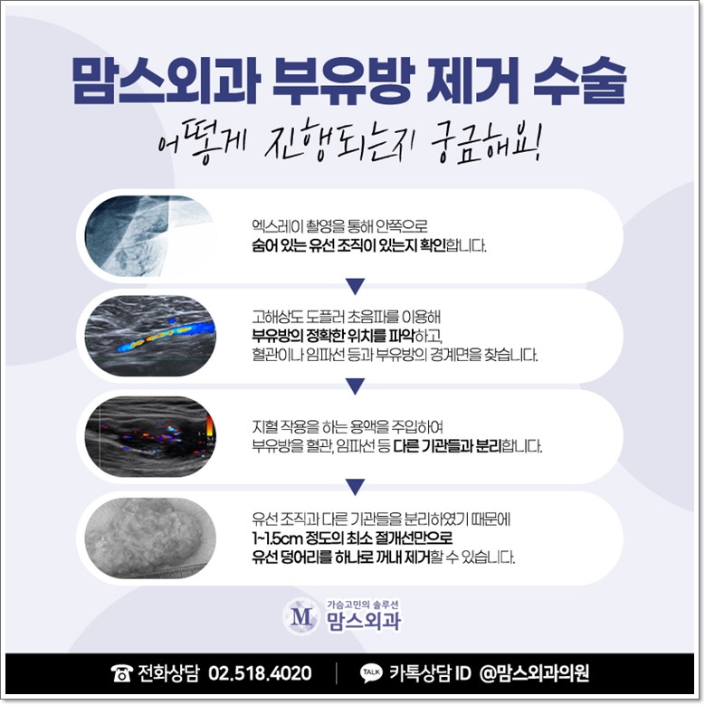 겨드랑이지방흡입 먹히지 않는다면 관련 이미지 9