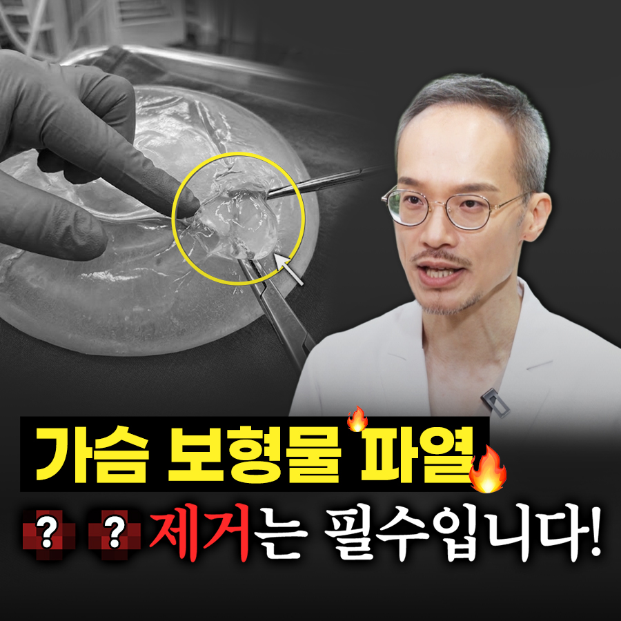 가슴 보형물 파열 피막제거는 필수입니다! 관련 이미지 1