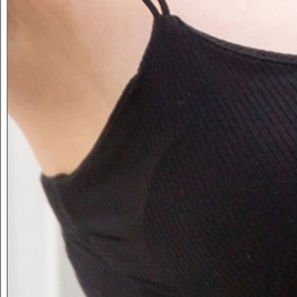 Breast Sagging Surgery to Regain Firmness image 18