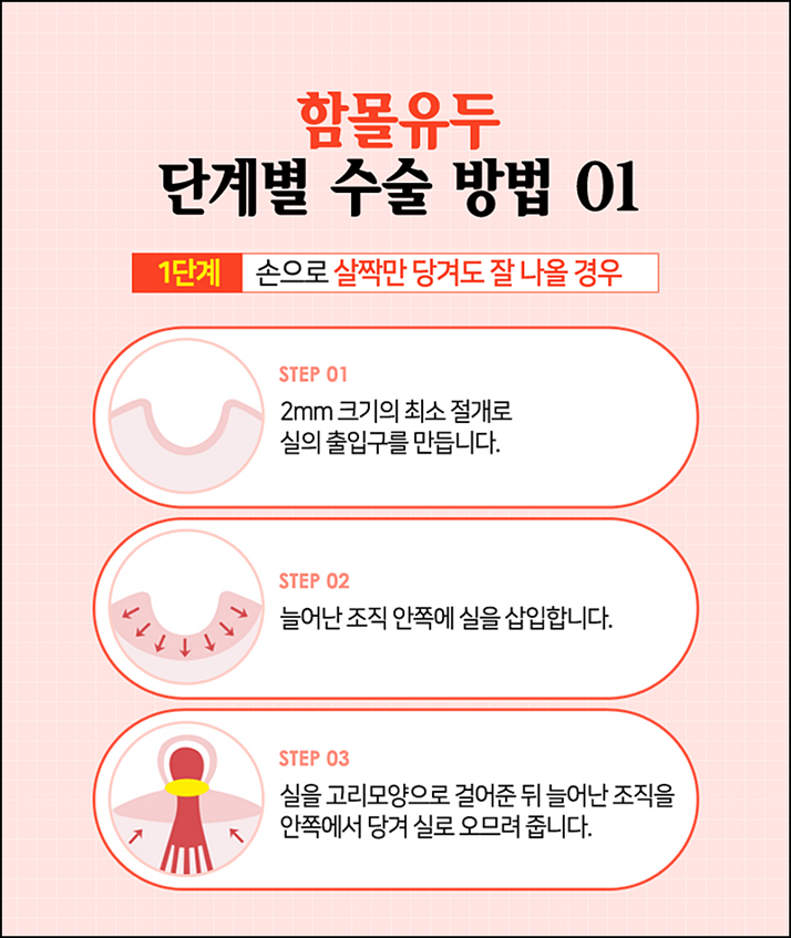함몰유두교정 시선에 부담되니까 관련 이미지 6