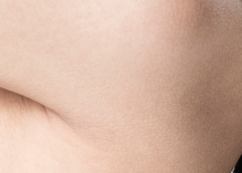 What Is the Right Customized Solution for Nipple Surgery? image 18