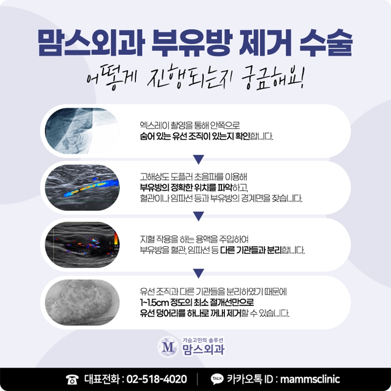 겨드랑이살빼기 쉽게 안 빠진다면 관련 이미지 9