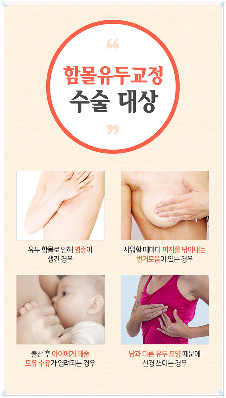 함몰유두수술가격 단계별로 생각해보자! 관련 이미지 4