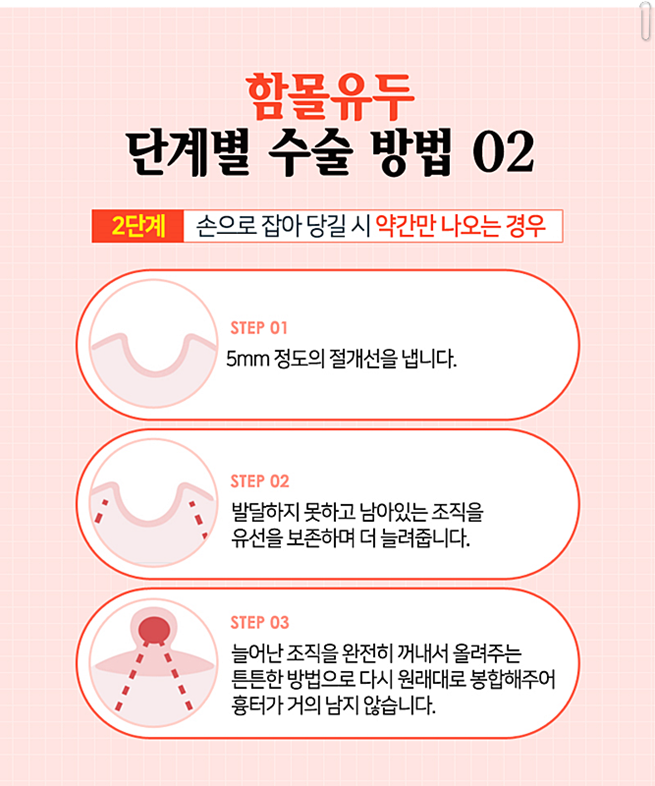 함몰유두수술후기 어떻게 변할까 관련 이미지 8