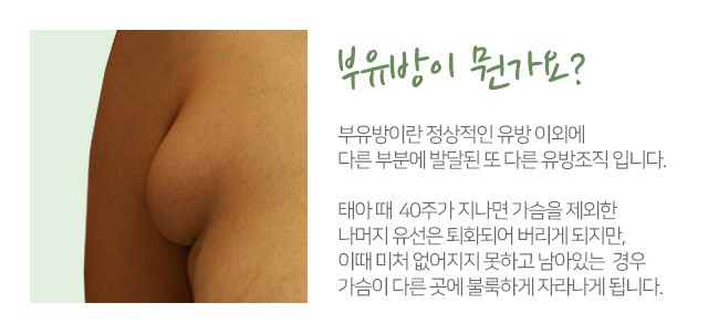 겨드랑이 혹 단단하게만져지나요? 관련 이미지 2