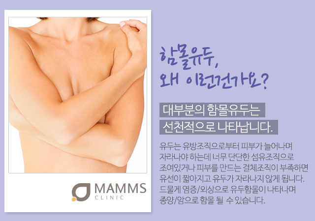함몰유두수술 나에게맞게 관련 이미지 2