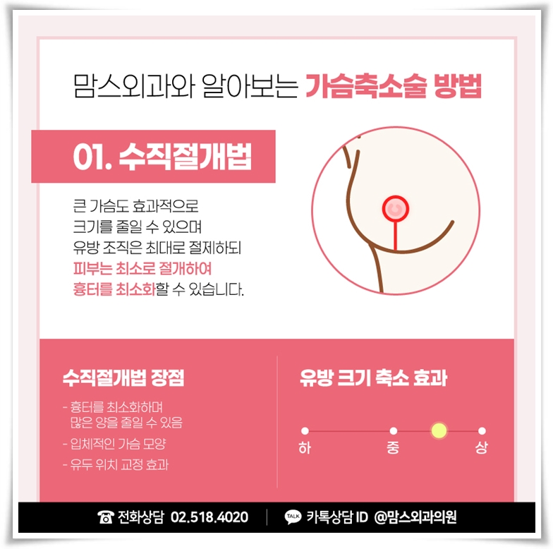 거대유방수술 아름다움과 편안함을 원한다면 관련 이미지 6