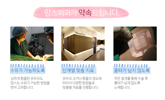 함몰유두수술 필요성에대해 관련 이미지 4
