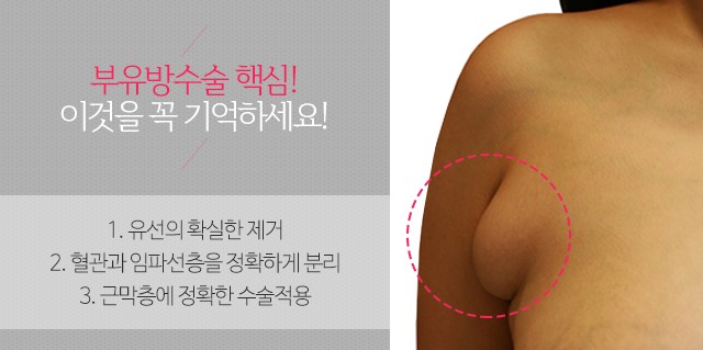 부유방수술 일석이조의효과 관련 이미지 2