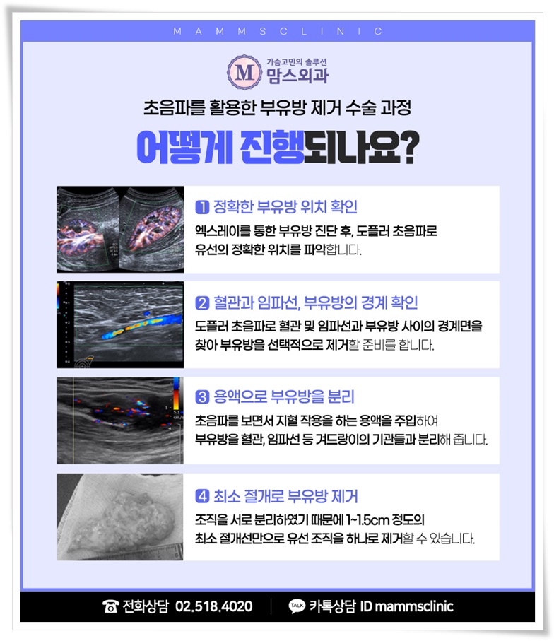 부유방제거로 삶의 질을 위해 관련 이미지 8