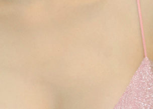 겨드랑이살 볼륨 줄이고 슬림한 라인을 원한다면? 관련 이미지 17