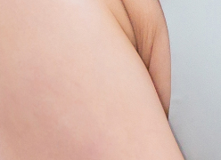 Breast Lift for Sagging Breasts: Lift Your Bust, Lift Your Confidence! image 19
