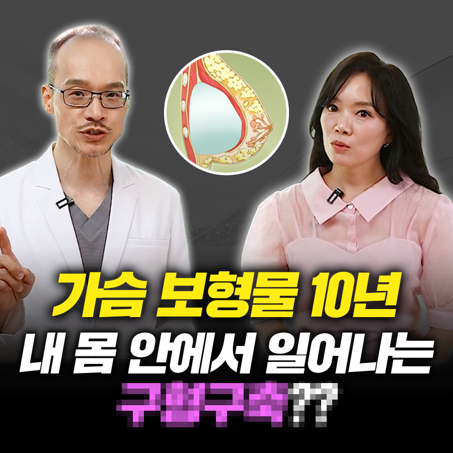 가슴 보형물 수술 10년 후, 왜 결국 관련 이미지 1