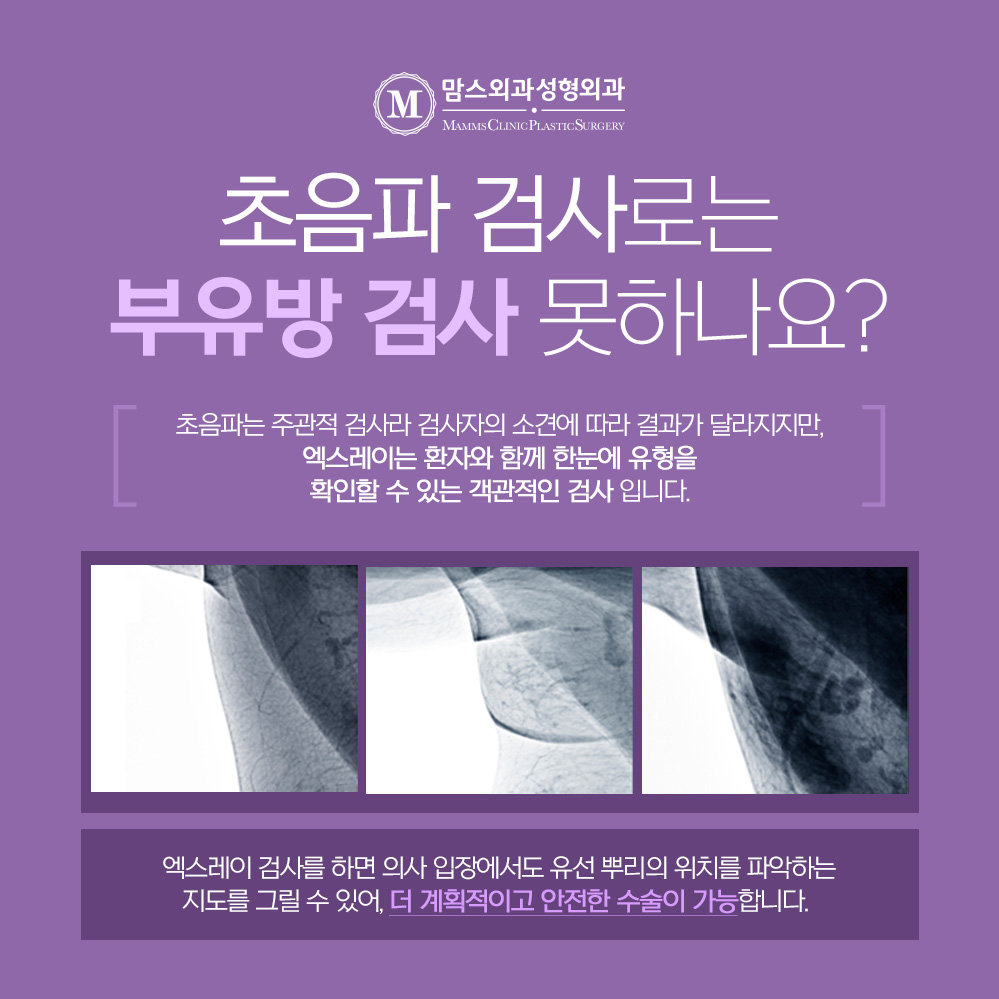 Safe Axillary Accessory Breast Removal Surgery with the Touch of a Breast Surgery Specialist! image 3