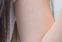 Careful Axillary Lump Clinic: Comprehensive Postoperative Support, Including Scar Care! image 22