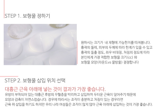 가슴확대수술후기 따져보셨나요? 관련 이미지 3